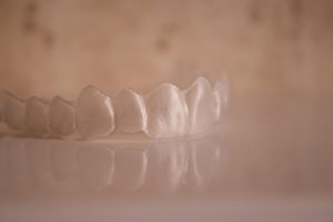 clear plastic aligner